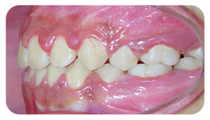 Right Buccal View