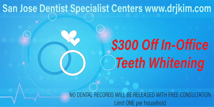 $300 Off