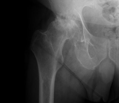 Dr David Hayes
Hip & Knee Surgeon