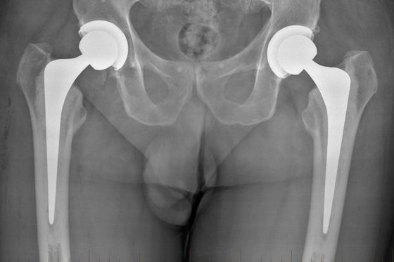 Dr David Hayes
Hip & Knee Surgeon