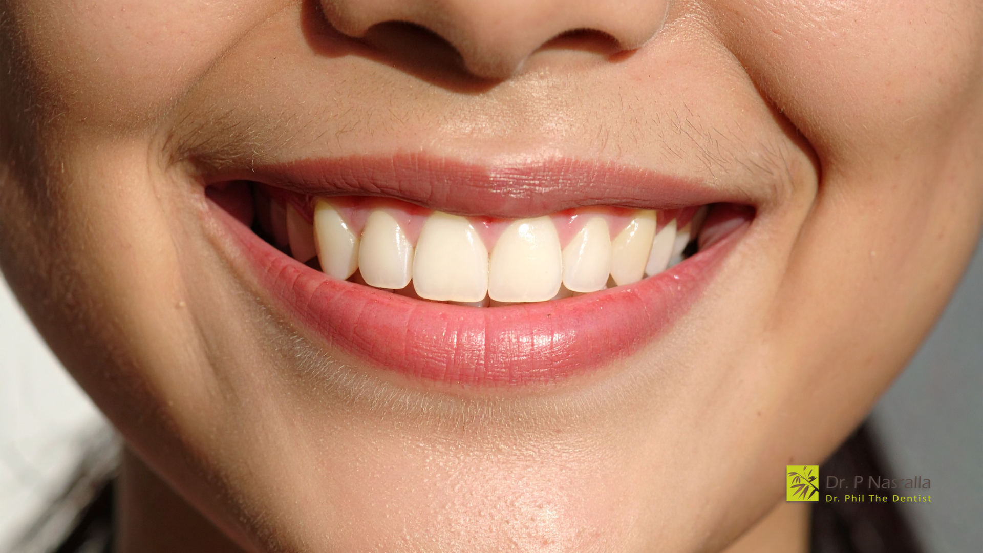 Close-up of a smiling mouth showing straight, white teeth and pink lips.