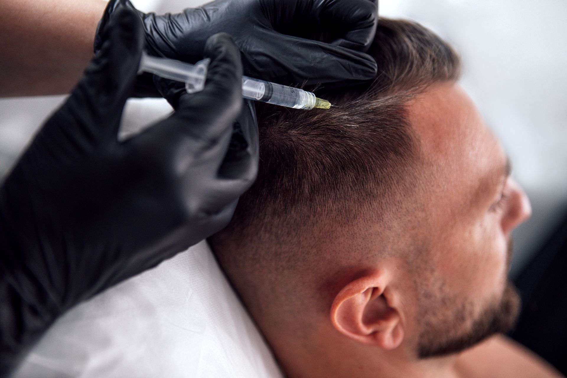 Hair Restoration