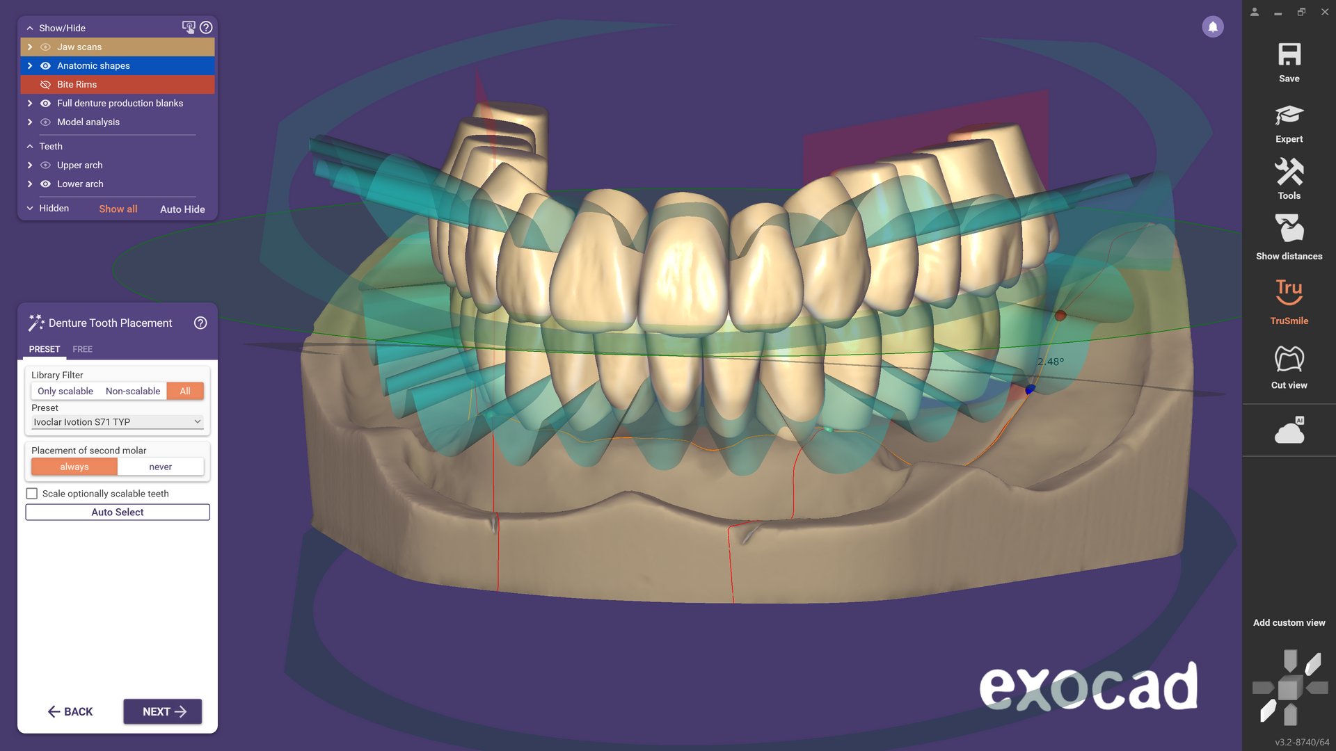 exocad DentalCAD Flex license Ultimate Bundle