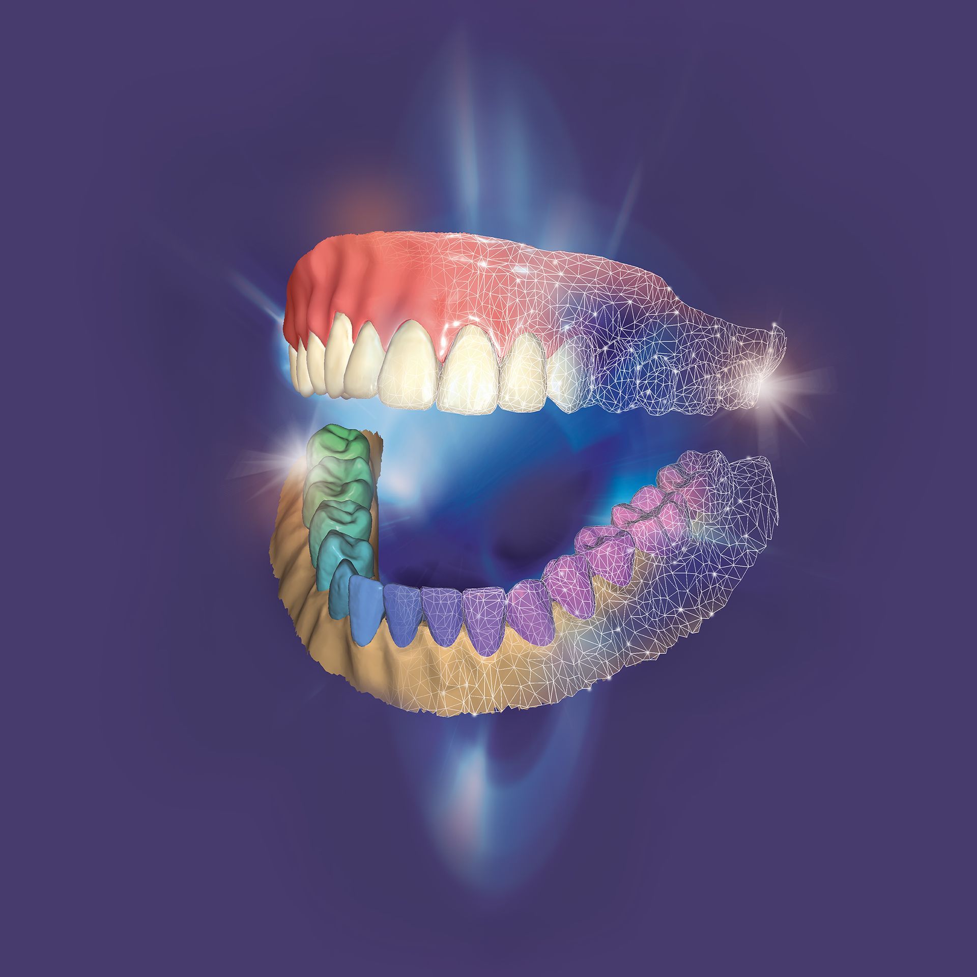 exocad DentalCAD Perpetual license Ultimate Bundle