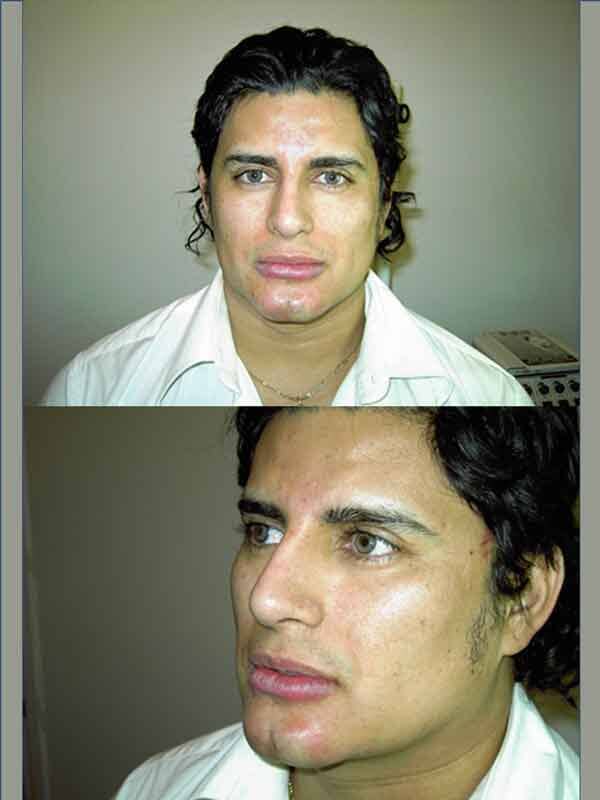 COSMÉTICA CONDESA -Tratamientos-contra-manchas