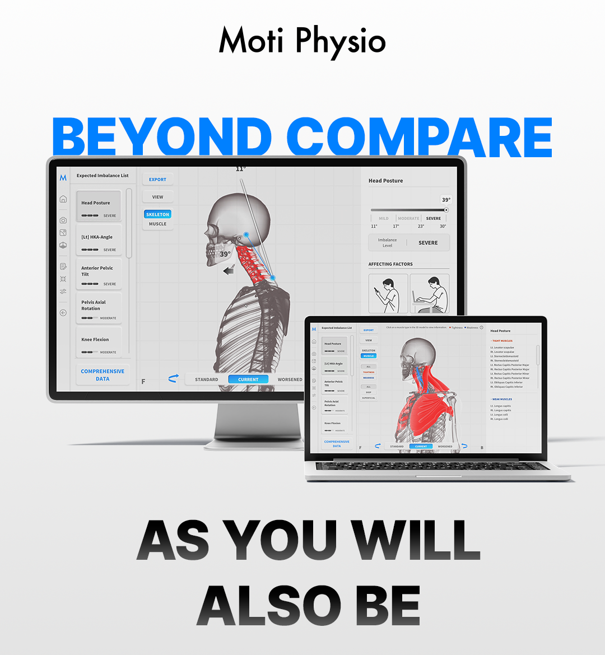 Moti Physio promo with laptop and tablet showing a spine analysis interface and the text “BEYOND COMPARE AS YOU WILL ALSO BE”
