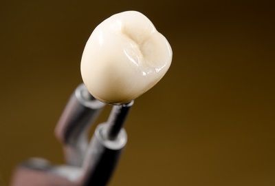 Close-up of a white dental crown held by metal tweezers on a brown background