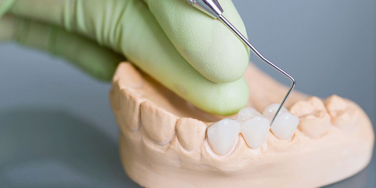 Gloved hand using a dental tool to examine a model of teeth