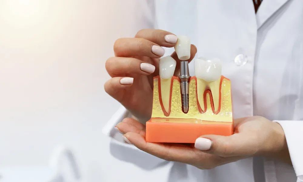 Hand holding a dental implant model showing teeth, gums, and roots