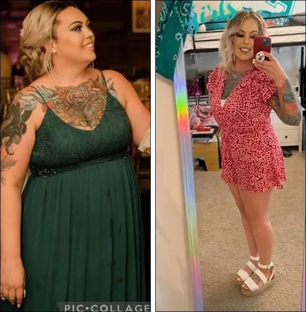 Before & After weight loss treatment
