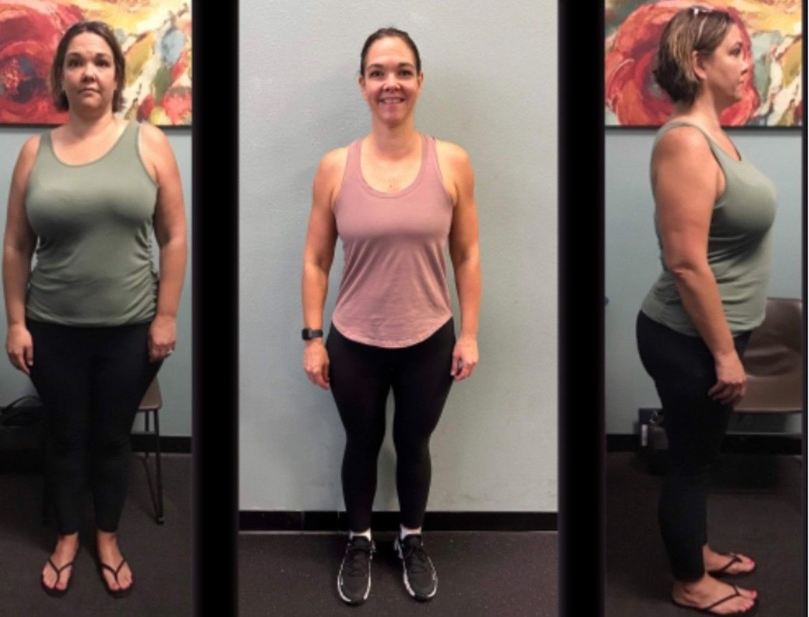 A person Before & After weight loss
