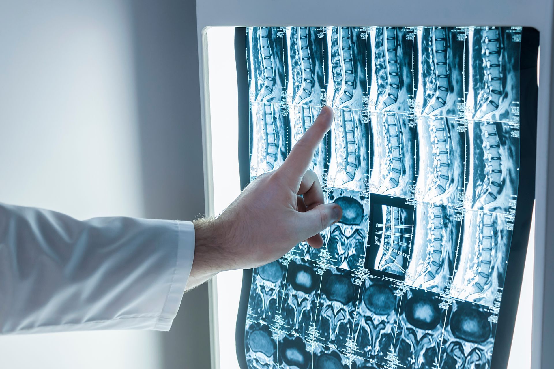 Arzt zeigt auf Gehirnscans auf einem hintergrundbeleuchteten Röntgenbildschirm