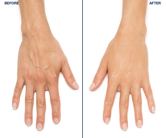 Skincare promo with woman applying cream, gold accents, ingredient icons, and before-after treatment steps