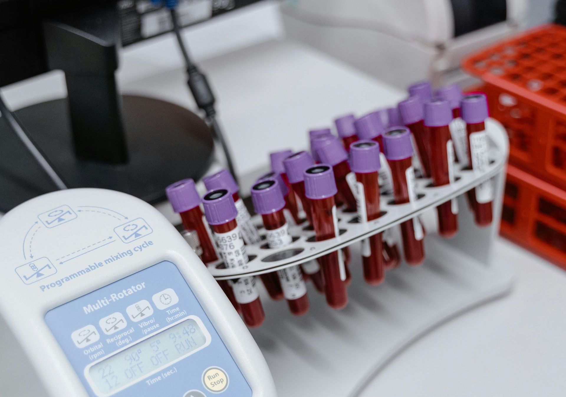 Fazer exames de sangue periódicos é de suma importância no processo de emagrecimento.