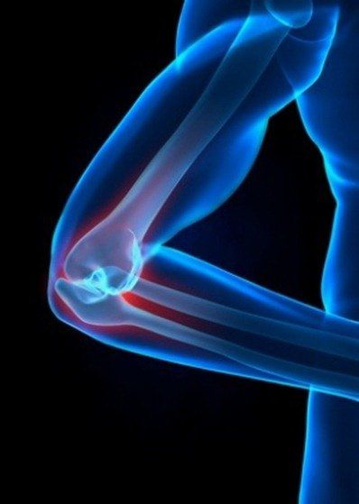 préjudice corporel