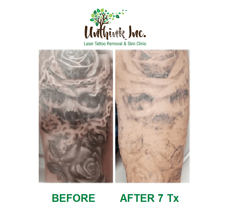 Unthink Inc before and after image 2