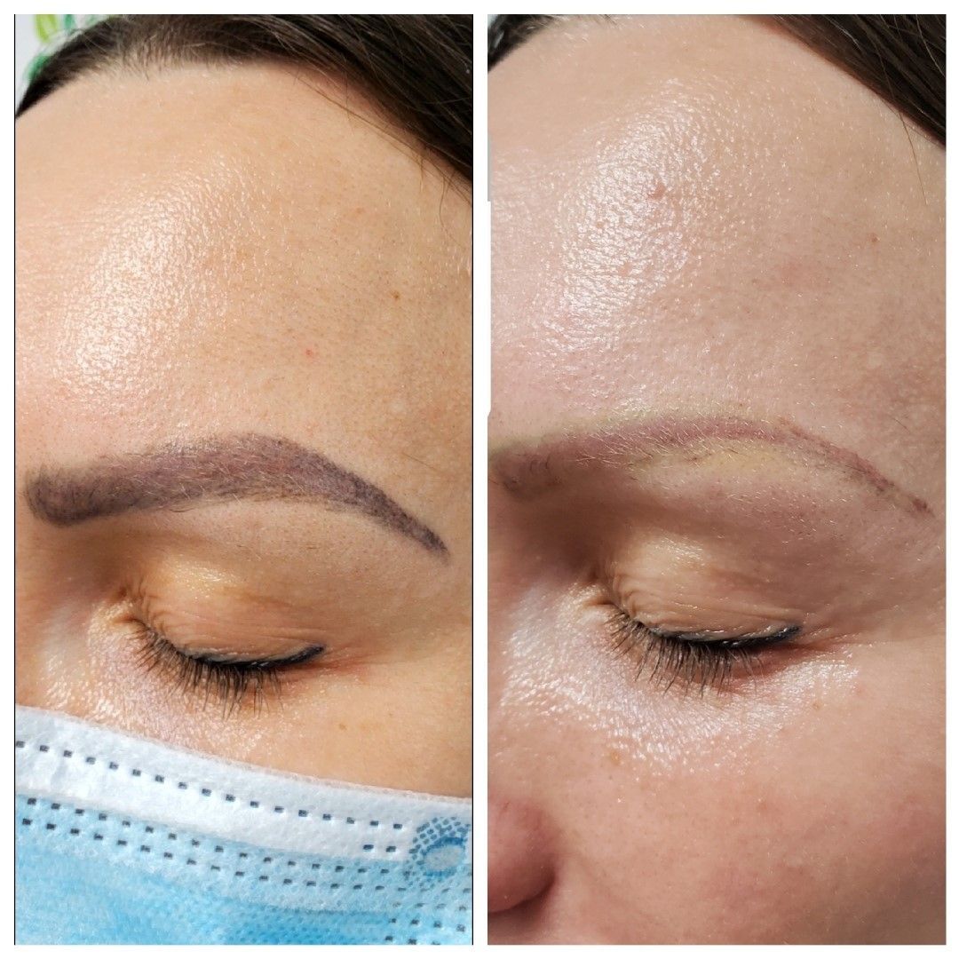 Two close-up photos of a person's eyebrow before and after a cosmetic procedure. One brow is darker and shaded.