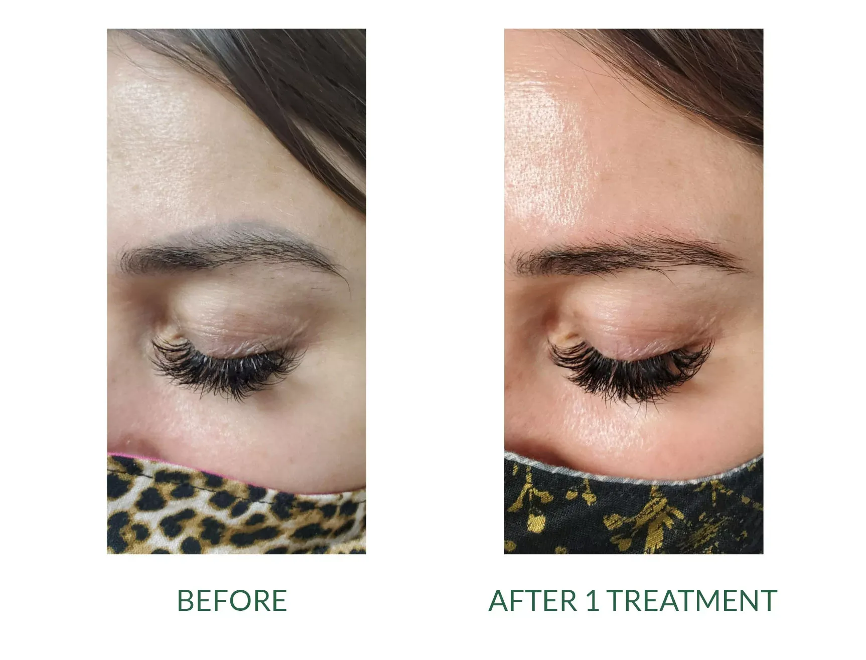 Side-by-side close-up of an eye before and after one treatment, showing darker and smoother eyebrow area