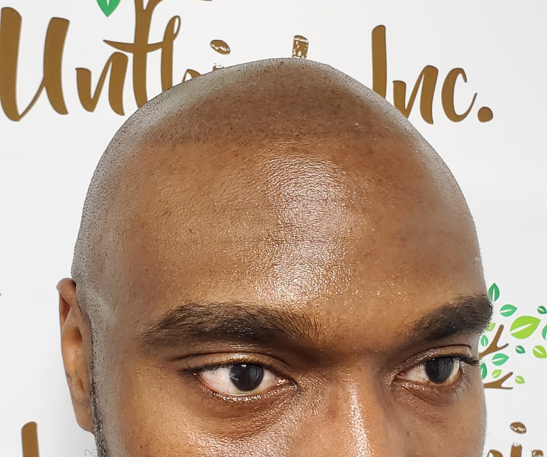 Close-up of a shaved head and eyes against a branded step-and-repeat backdrop