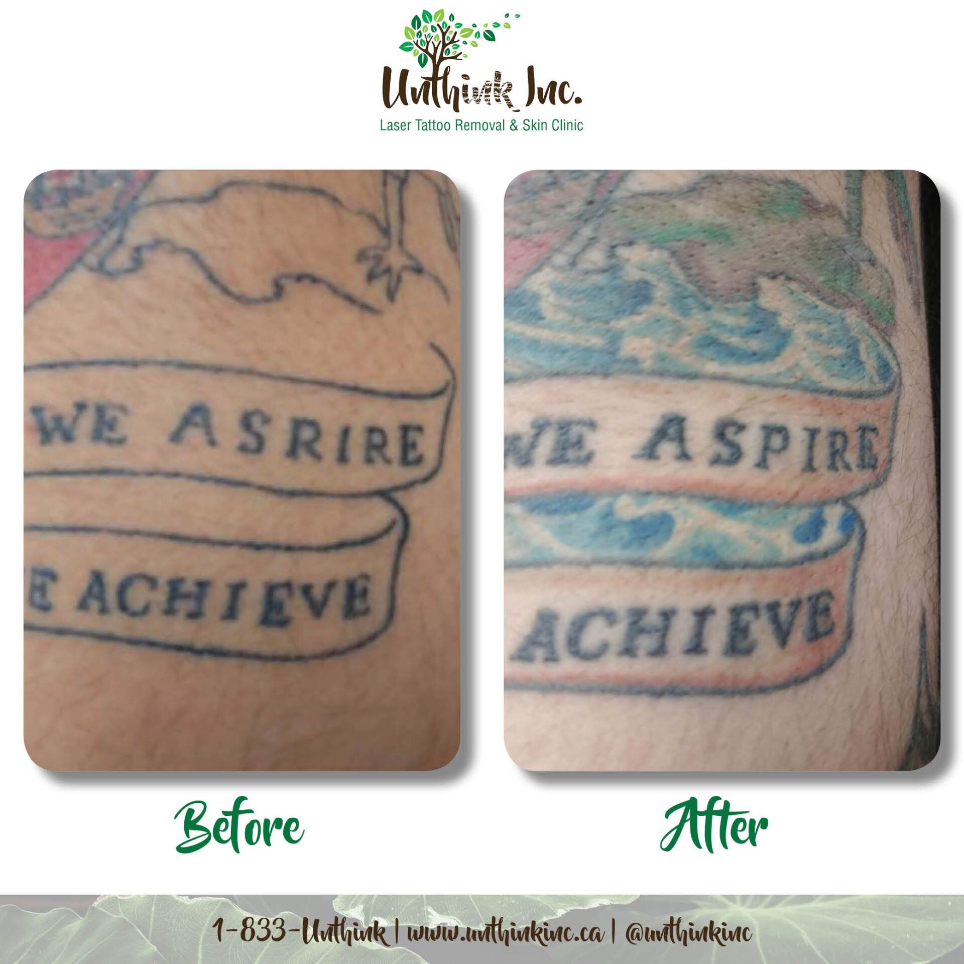 Before-and-after tattoo restoration: faded banner tattoo on skin restored to blue and clearer text.
