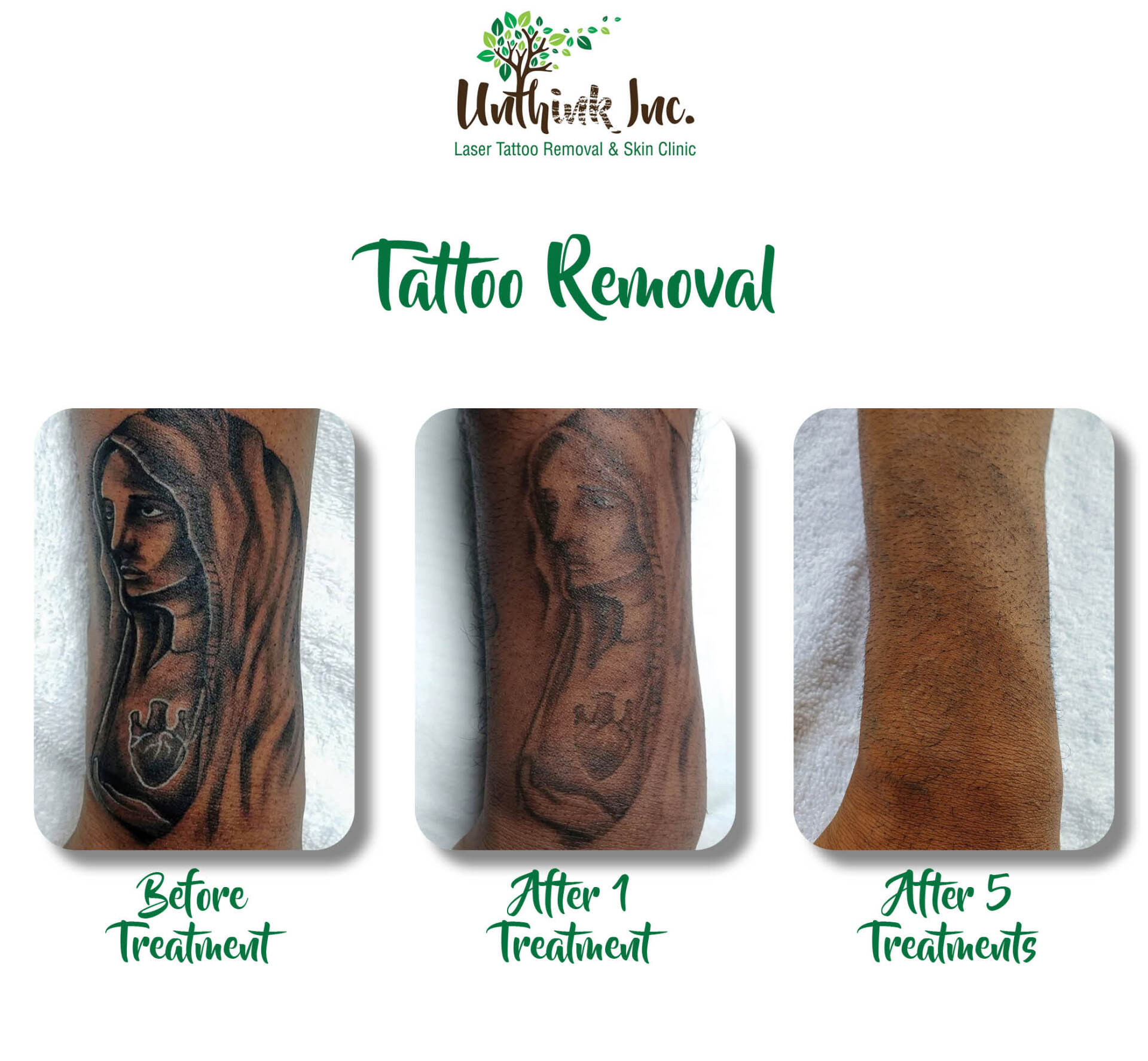 Unthink Inc before and after image