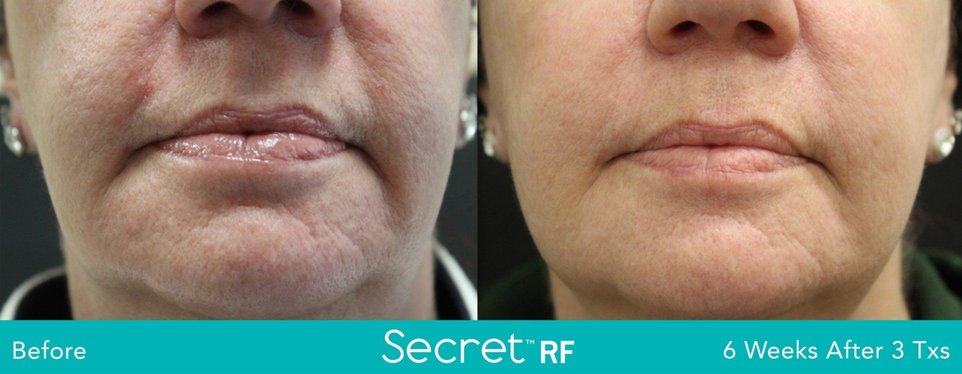 A before and after photo of a woman 's face