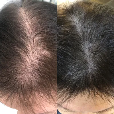 A before and after picture of a person 's hair