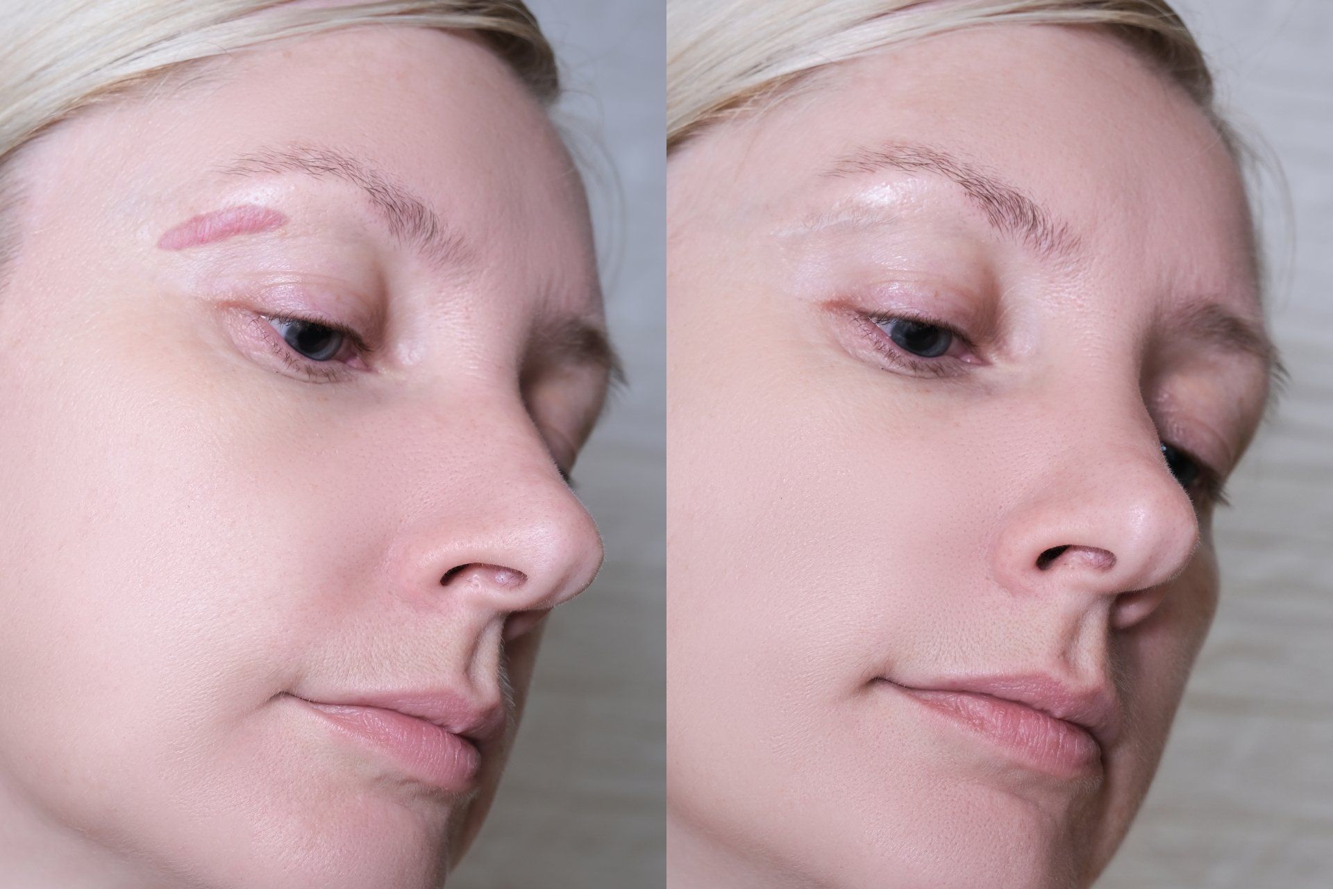 A before and after photo of a woman 's face with and without makeup.