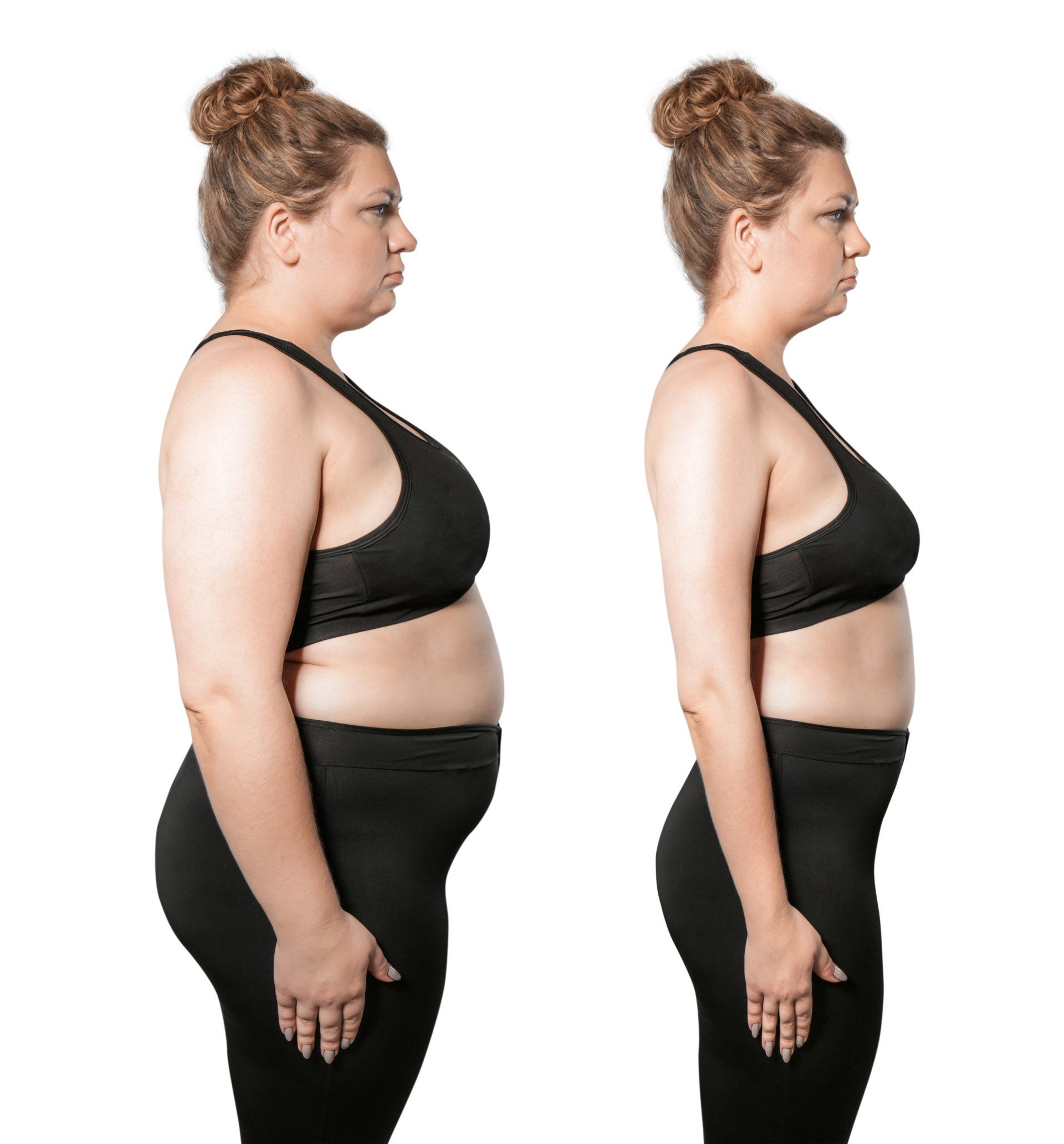 A woman is shown before and after losing weight.