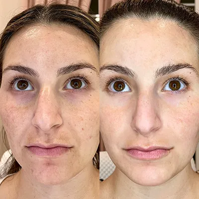 A before and after photo of a woman 's face with and without makeup.
