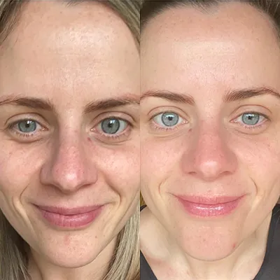 A before and after photo of a woman 's face with and without makeup.