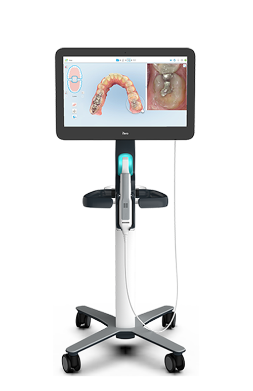 INTRA-ORAL CAMERA?