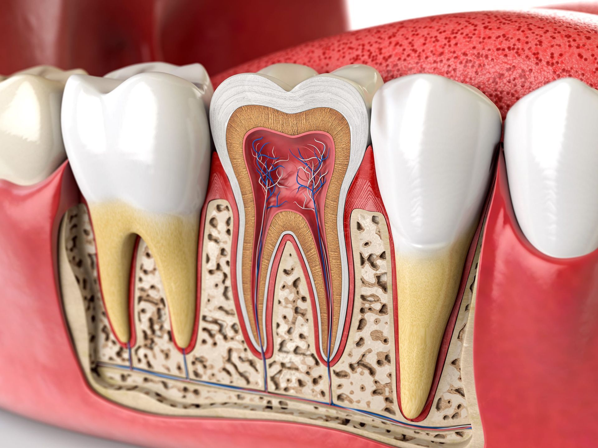 ROOT CANAL TREATMENT