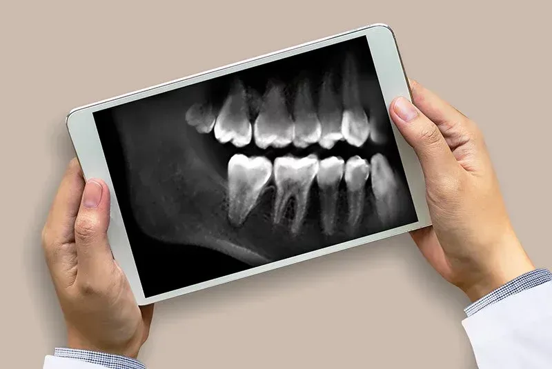 DENTAL X-RAY
