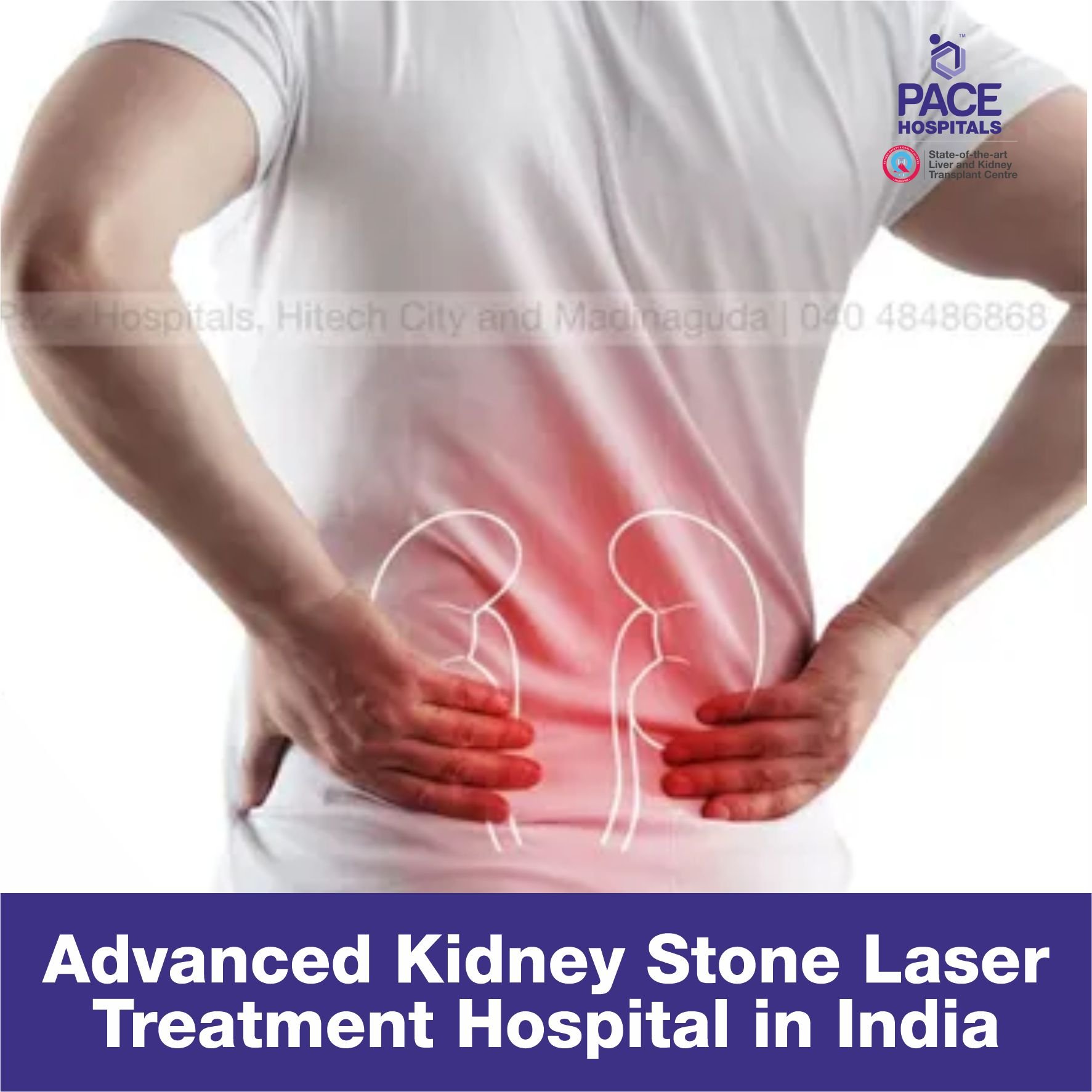 Best Hospital for Kidney Stones Treatment in Hyderabad, Cost & Benefit