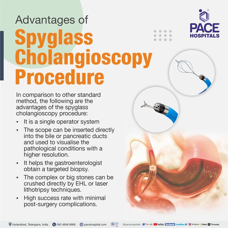 Spyglass Cholangioscopy in Hyderabad, India Indications & Cost