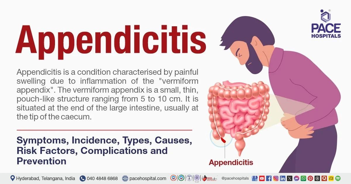 Appendicitis Appendicitis