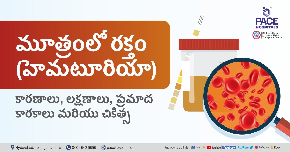 మూత్రంలో రక్తం (హెమటూరియా) కారణాలు, లక్షణాలు మరియు చికిత్స
