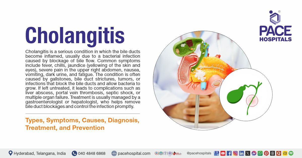 Cholangitis: Types, Symptoms, Causes, Diagnosis, & Treatment