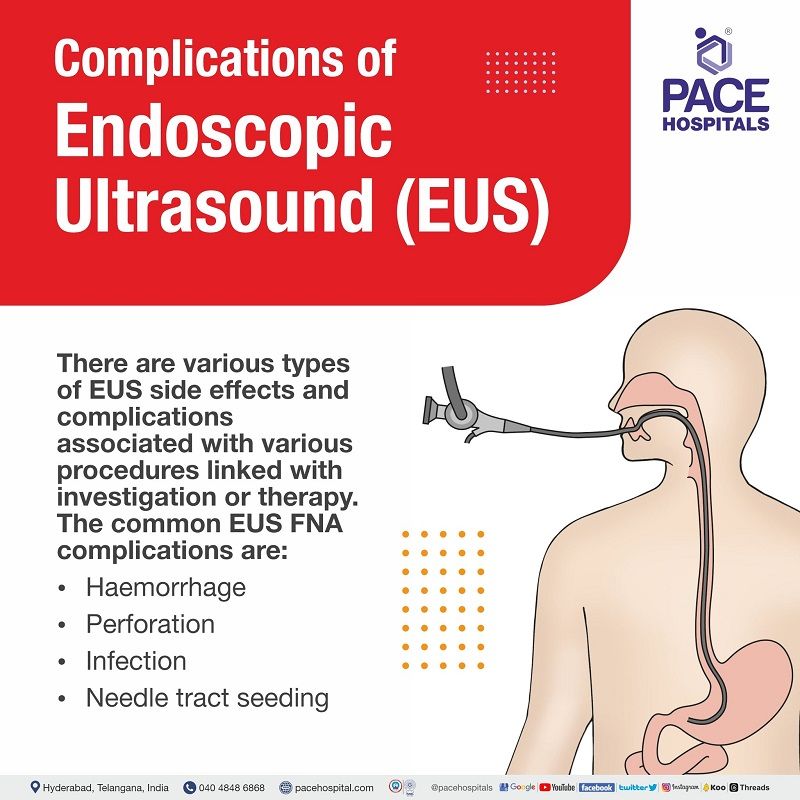 Endoscopic Ultrasound (EUS) in Hyderabad, India Uses & Cost