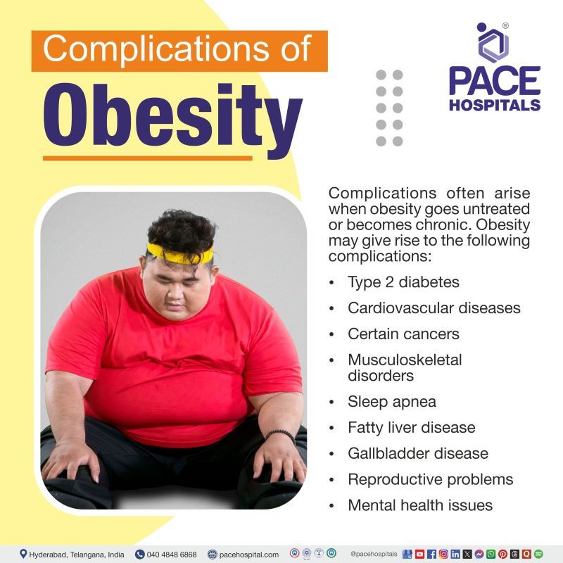 Obes Obesity - Symptoms, Causes, Types, Diagnosis & Treatment