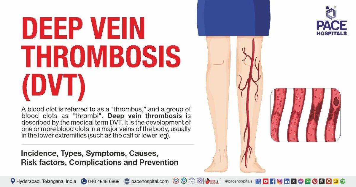 Deep Vein Thrombosis (DVT)- Symptoms, Causes and Complications