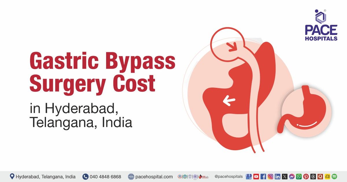 Affordable Gastric Bypass Surgery Cost in Hyderabad, India