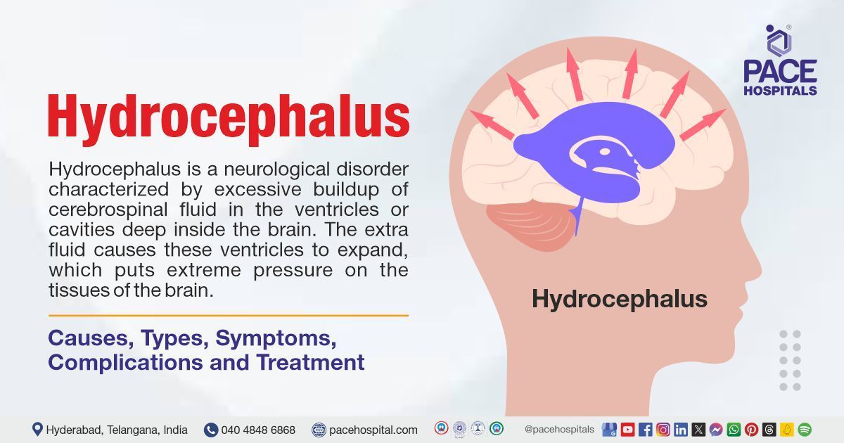Hydrocephalus Causes Types Symptoms Treatment Complication