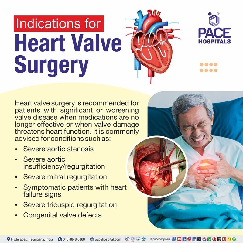 Best Hospital for Heart Valve Surgery in Hyderabad, India