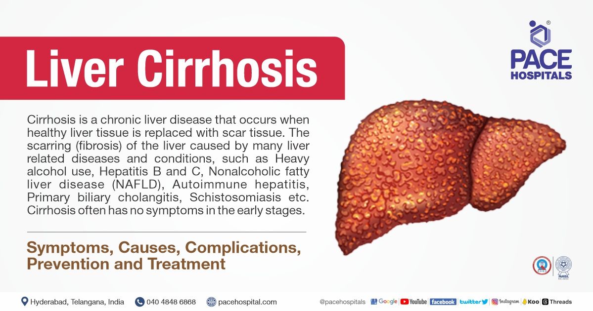 End Stage Liver Disease Symptoms Causes Complications 41 OFF