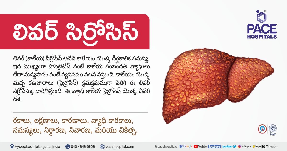 లివర్ (కాలేయ) సిర్రోసిస్ లక్షణాలు, కారణాలు, సమస్యలు, నివారణ