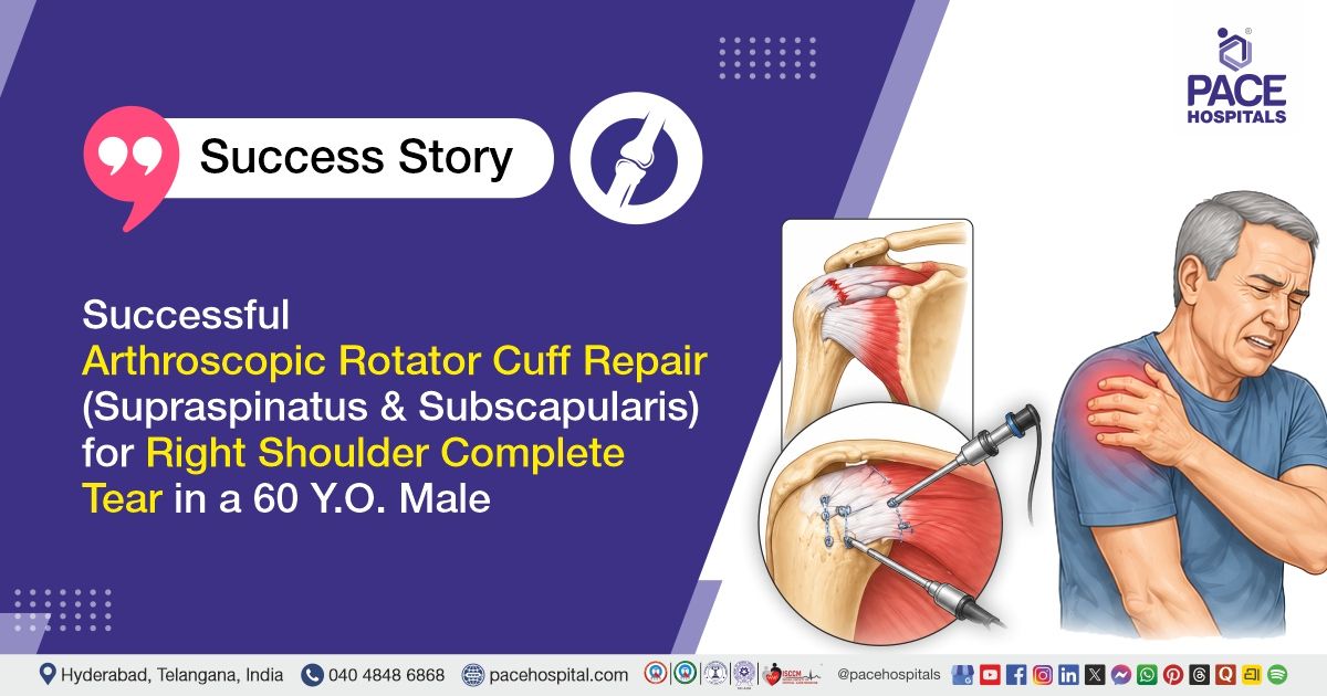 Arthroscopic Rotator Cuff Repair for Complete Shoulder Tear