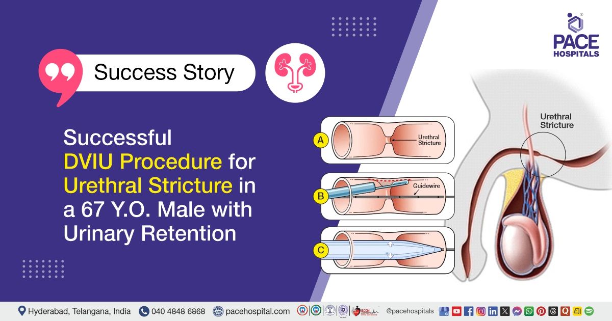 Purethal Injection DVIU Procedure for Urethral Stricture Treatment
