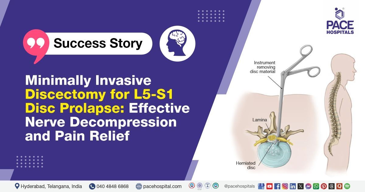 Successful Lumbar Discectomy for Intervertebral Disc Prolapse